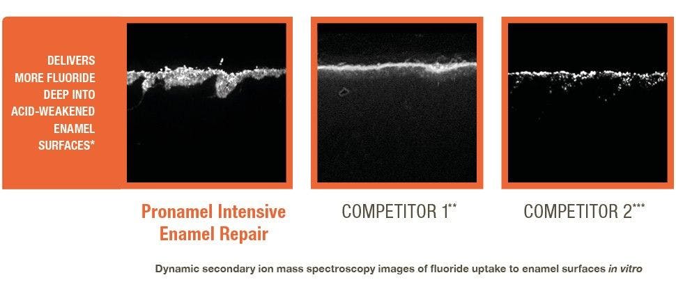 SEM of fluoride uptake