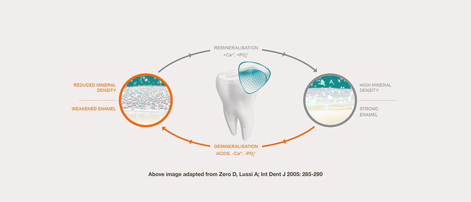Remineralisation / demineralisation cycle