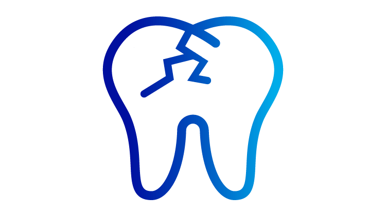 Cracked tooth image