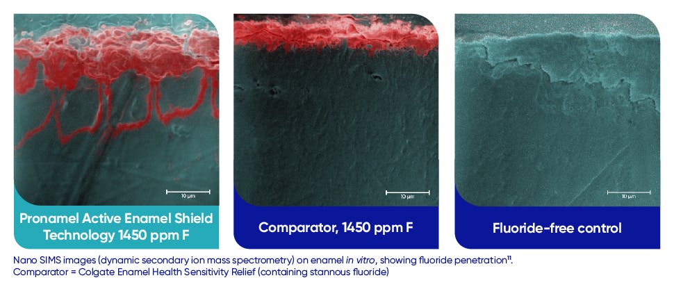 Images showing fluoride penetration of tooth enamel by Pronamel Active Enamel Shield toothpaste, compared with lesser penetration by a comparator toothpaste containing the same amount of fluoride