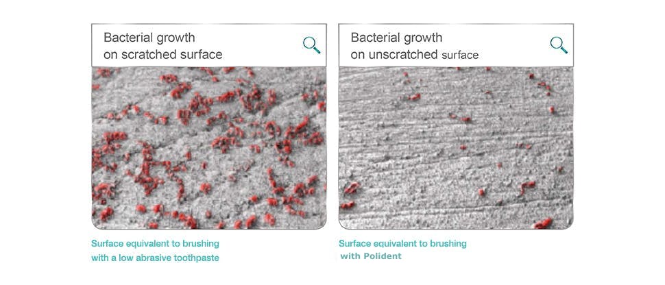 Scratched surface of dentures