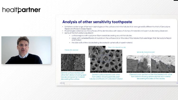 Dentine hypersensitivity