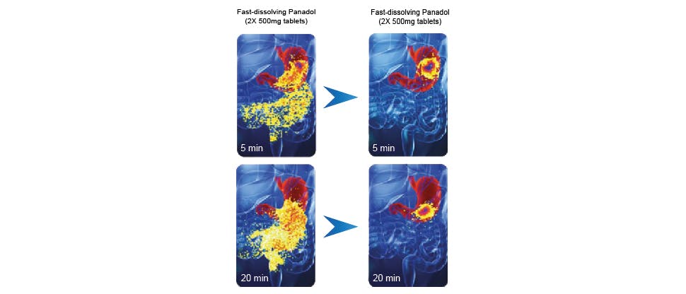 Images showing the rapidity of Panadol with Optizorb disintegration in the stomach compared to standard Panadol tablets