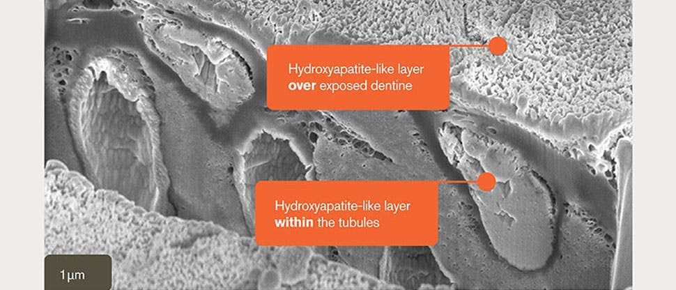 SEM image of hydroxyapatite-like layer