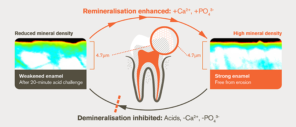 Dual protection of enamel