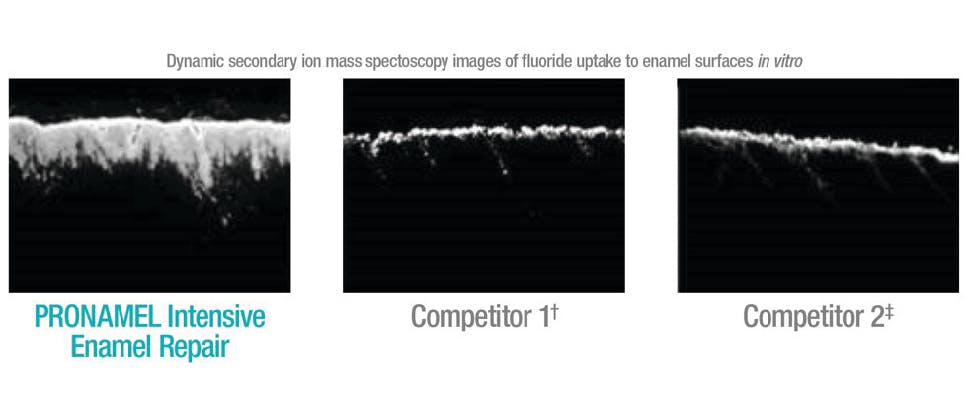 SEM of fluoride uptake