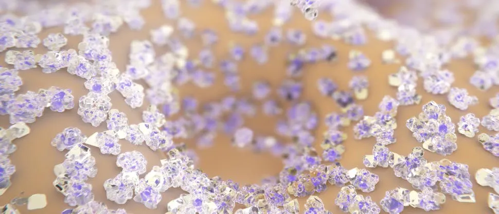 NOVAMIN forming a protective layer over exposed dentin 