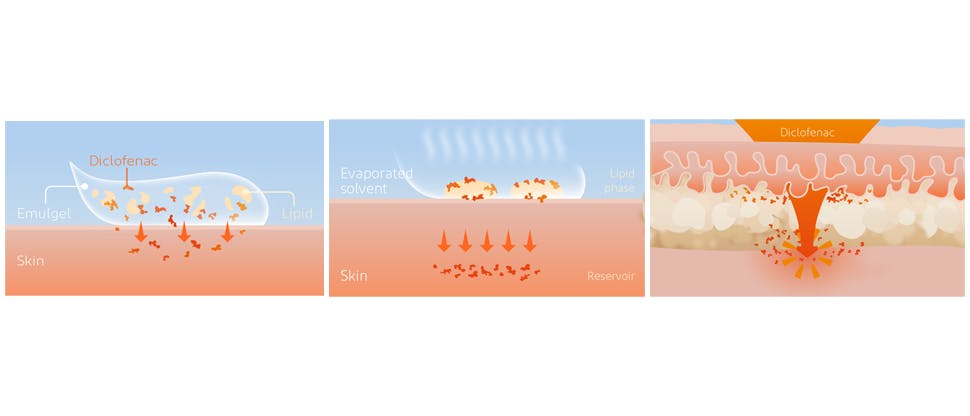 Voltaren 2.32 Gel 100G: Effectieve Pijnverlichting En Comfort Voor ...