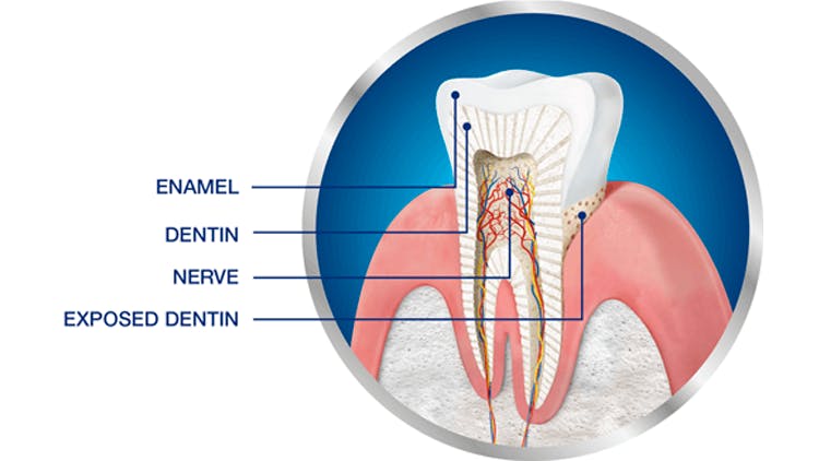 Section transversale de la dent