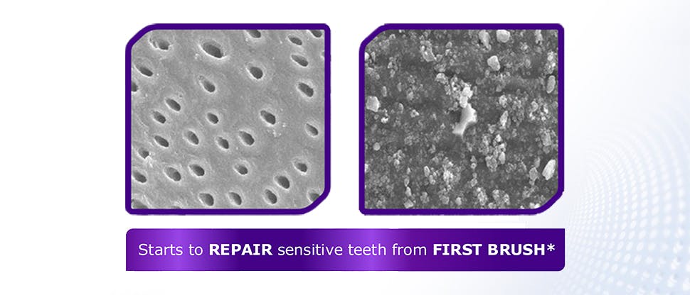 Image under a microscope of dentin tubules 