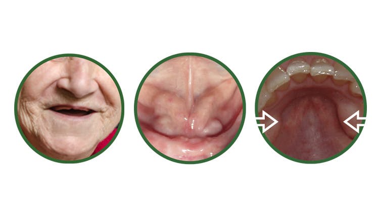 Oral anatomy