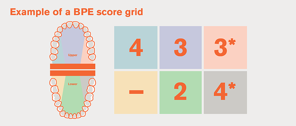 BPE division of dentition into sextants and grid example