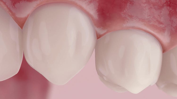 Image of healthy teeth and gums 