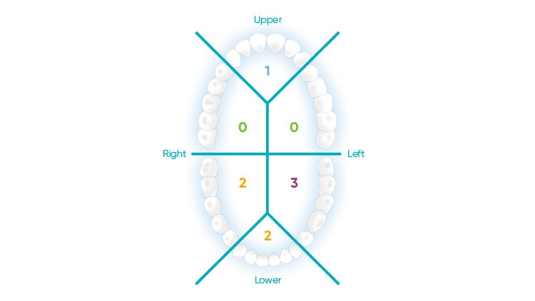 Erosive Tooth Wear Diagnosis | Haleon HealthPartner