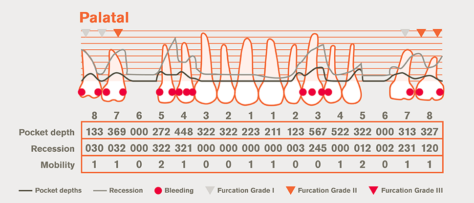 Detail periodontal chart
