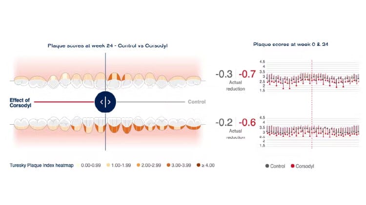 Image of the Corsodyl mouth map of clinical data 