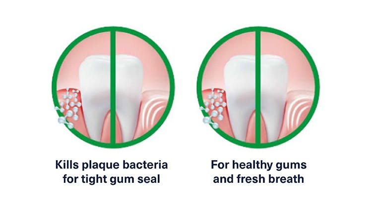 Graphic showing how Corsodyl Active Gum Repair removes plaque bacteria, tightens the gum seal and helps with teeth and gum health