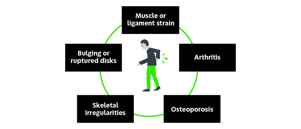 Graphic depicting potential causes of back pain