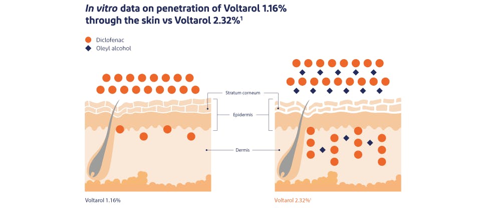 Voltarol skin penetration image