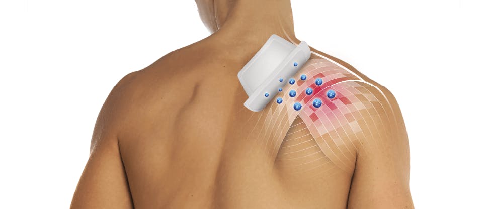 Image of man's back with highlighted shoulder pain and pain relief plaster applied.