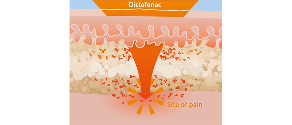 Diagram showing diclofenac reaching site of pain