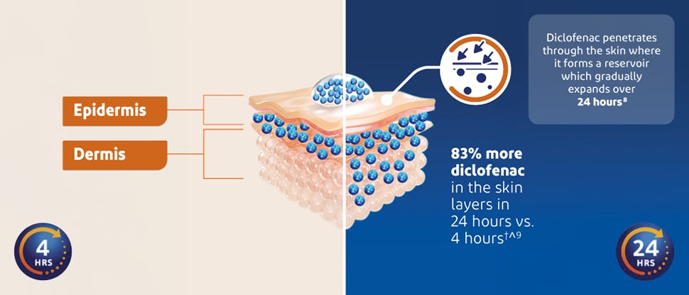 Image of the layers of the skin to demonstrate the fact that there is 83% more diclofenac in the skin layers in 24 hours vs 4 hours based on in vitro study 