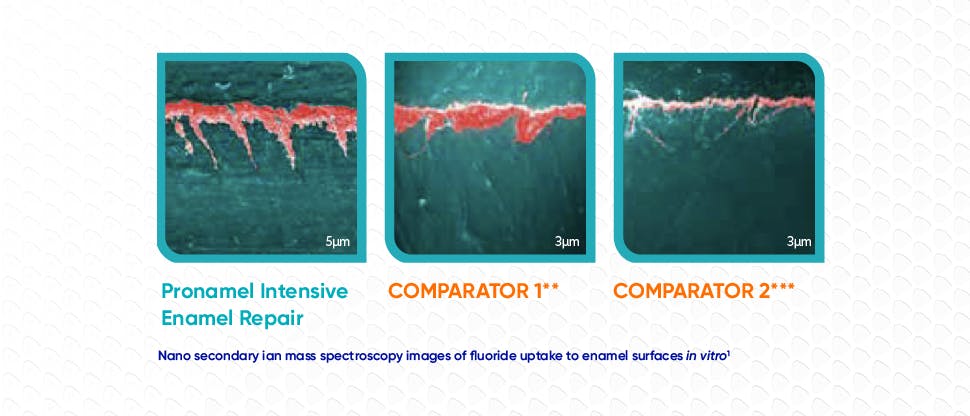 SEM of fluoride uptake