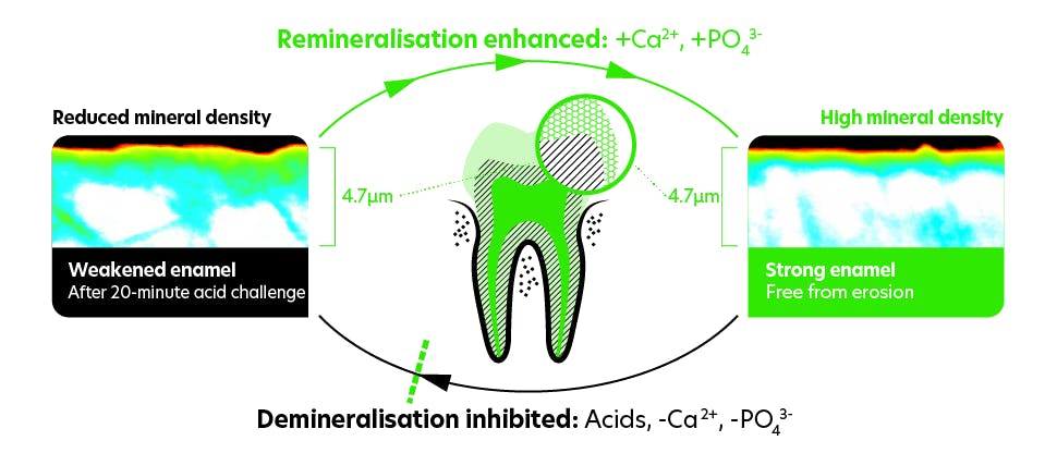 Cycle of remineralisation and demineralisation in the mouth