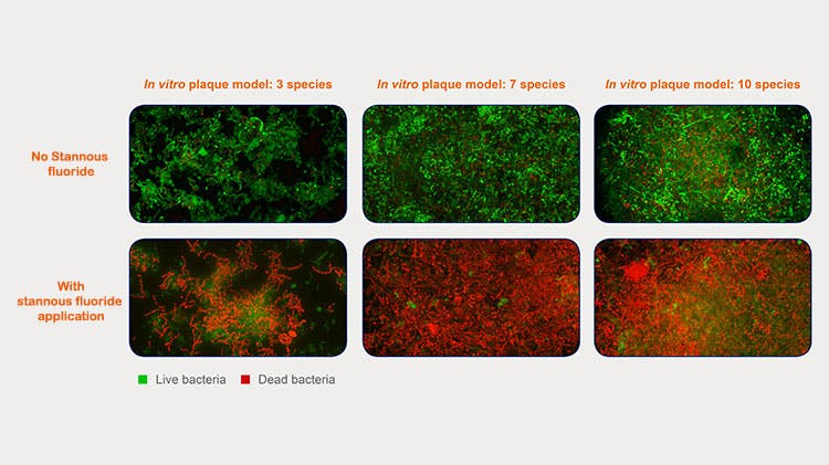 In vitro plaque model