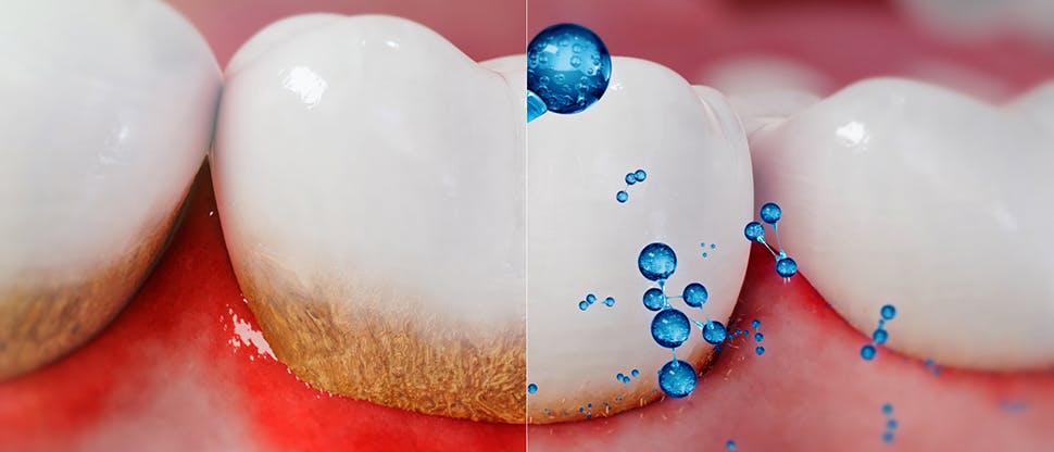 Driving new insight into the disruptive action of sodium bicarbonate