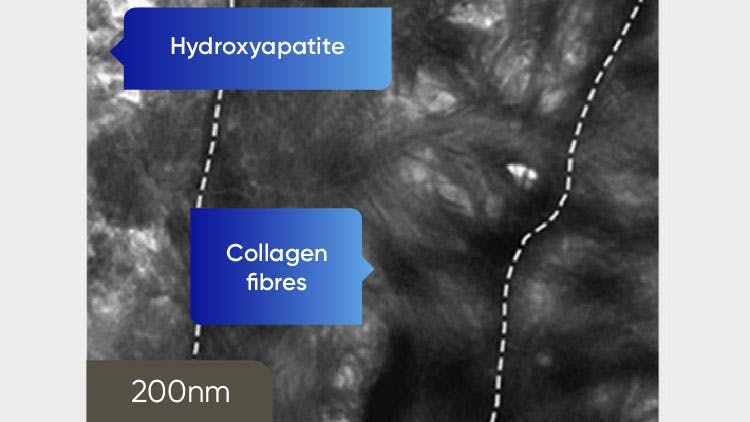 TEM image of dentine at 200nm