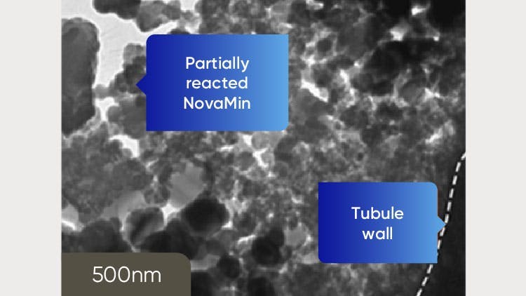 TEM image of dentine at 500nm