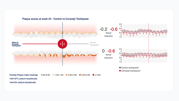 Interactive mouth map and plaque scores graph showing Control vs Corsodyl results 