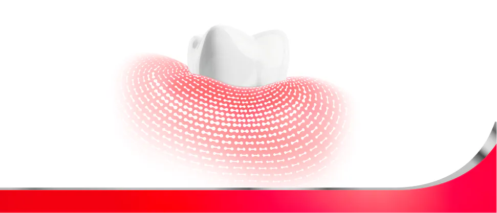 Graphic image of a tooth and surrounding red gum