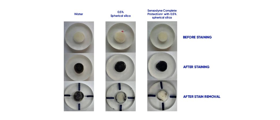 Image of tooth staining after brushing