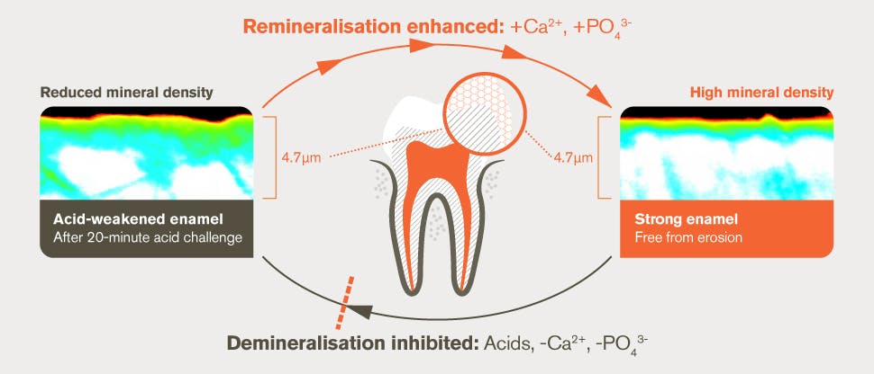 Dual protection of enamel