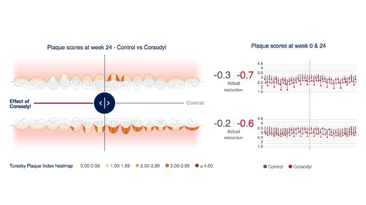 Image of the mouth map tool showing the reduction of plaque after using Corsodyl 67% sodium bicarbonate toothpaste compared to a regular fluoride toothpaste with twice daily brushing