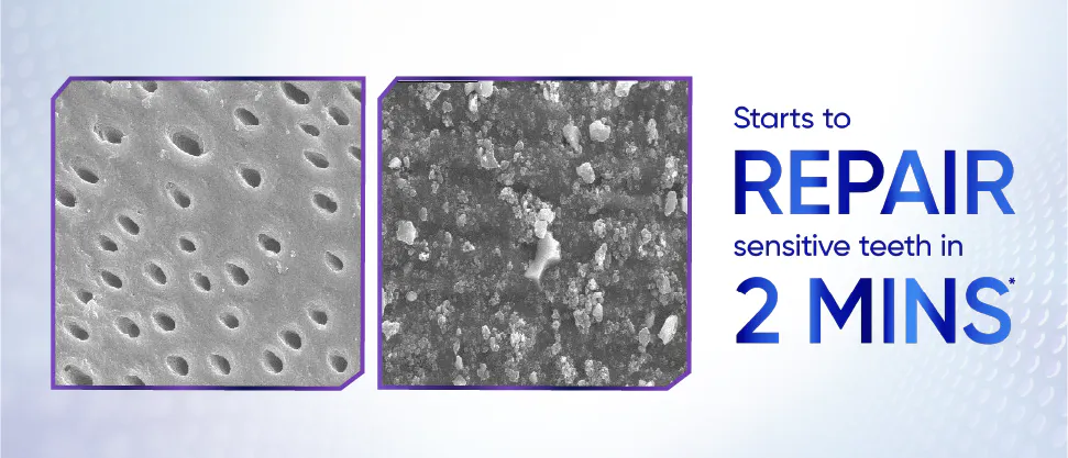 2 images of dentine surface showing dentine tubules. Next to the images there is a text "Starts to repair sensitive teeth in 2 minutes*"