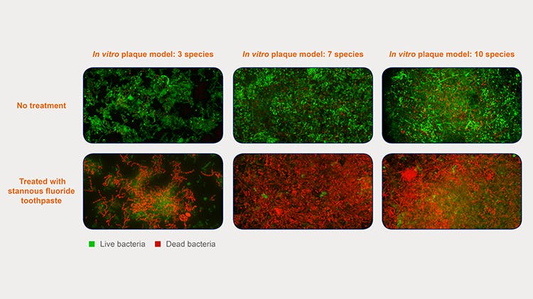 In vitro plaque model