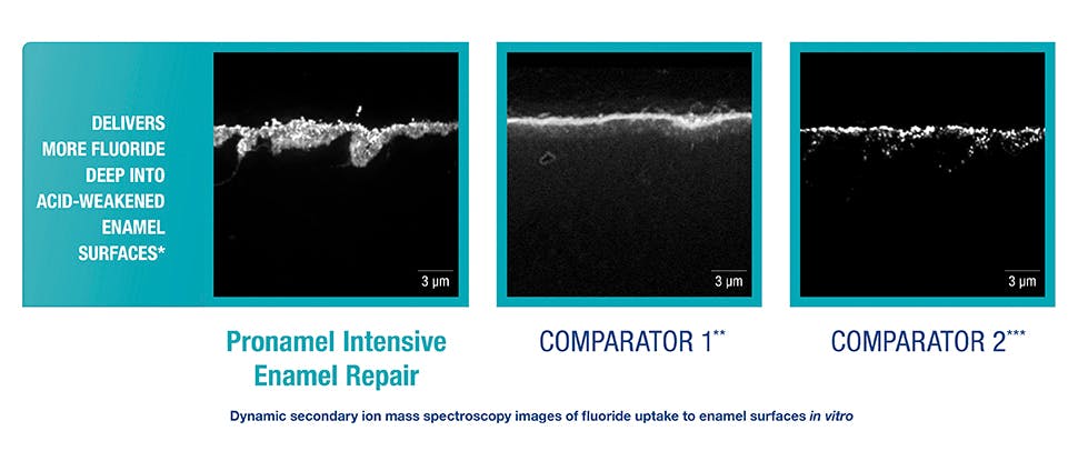 SEM of fluoride uptake