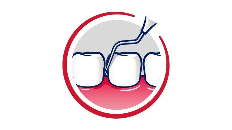 An animated icon showing interdental cleaning to help remove plaque and tartar from teeth.
