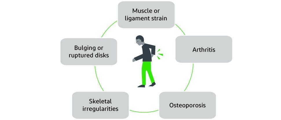 Graphic depicting potential causes of back pain