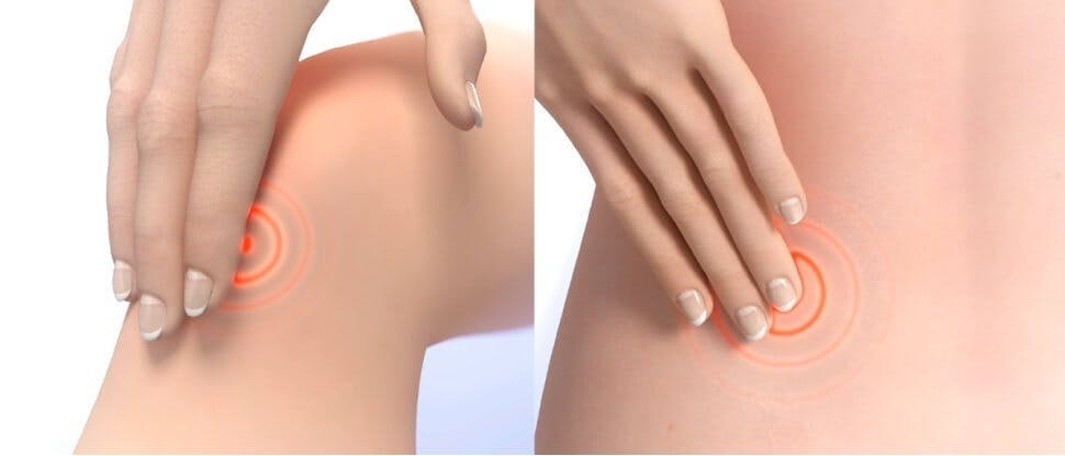 Analgesics can be used to relieve pain from sprains and strains