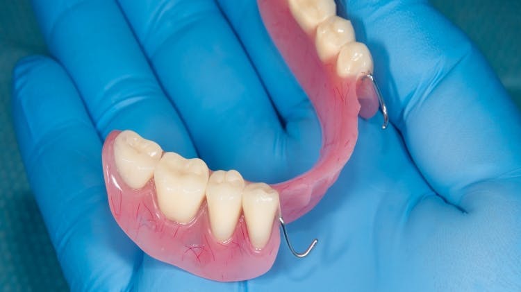 Image of immediate dentures 