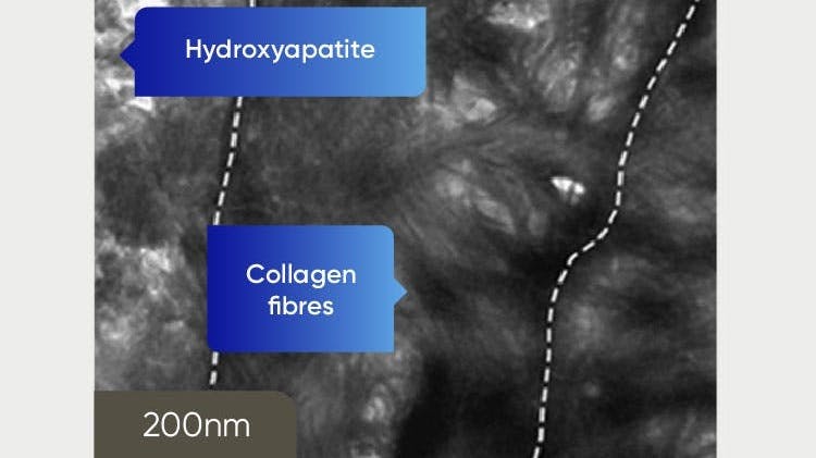 TEM image of dentine at 200nm