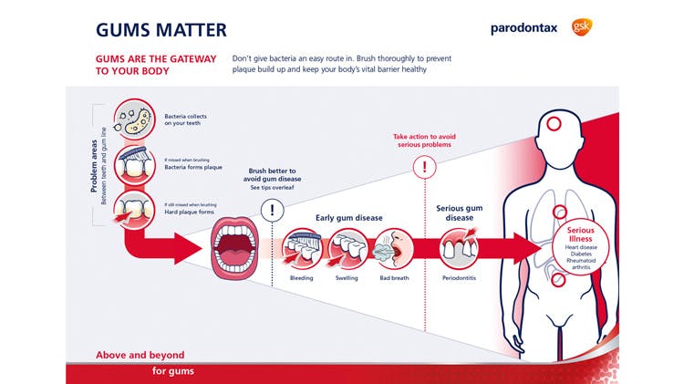 The science behind parodontax