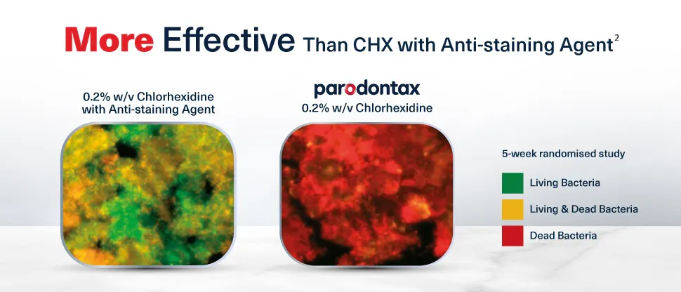 creative visualisation: Not all chlorhexidine formulations are the same
