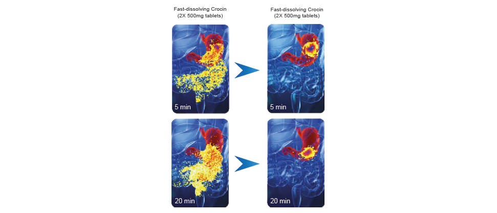Images showing the rapidity of Crocin Advance disintegration in the stomach compared to standard paracetamol tablets