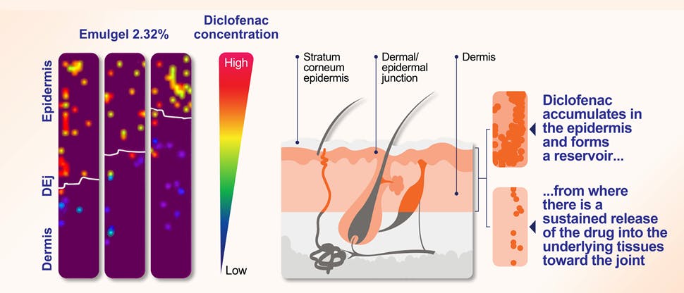 Study proved efficient delivery of diclofenac molecule into the target inflamed tissues