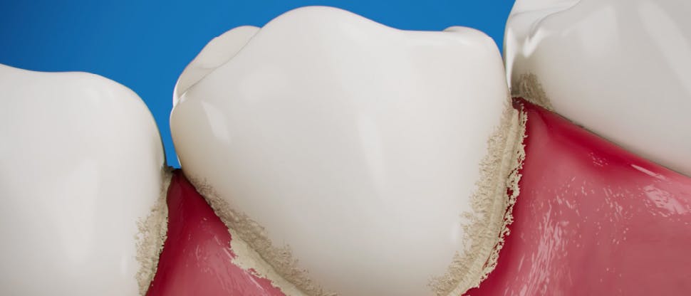 Sensitivity toothpaste micro foam technology in use